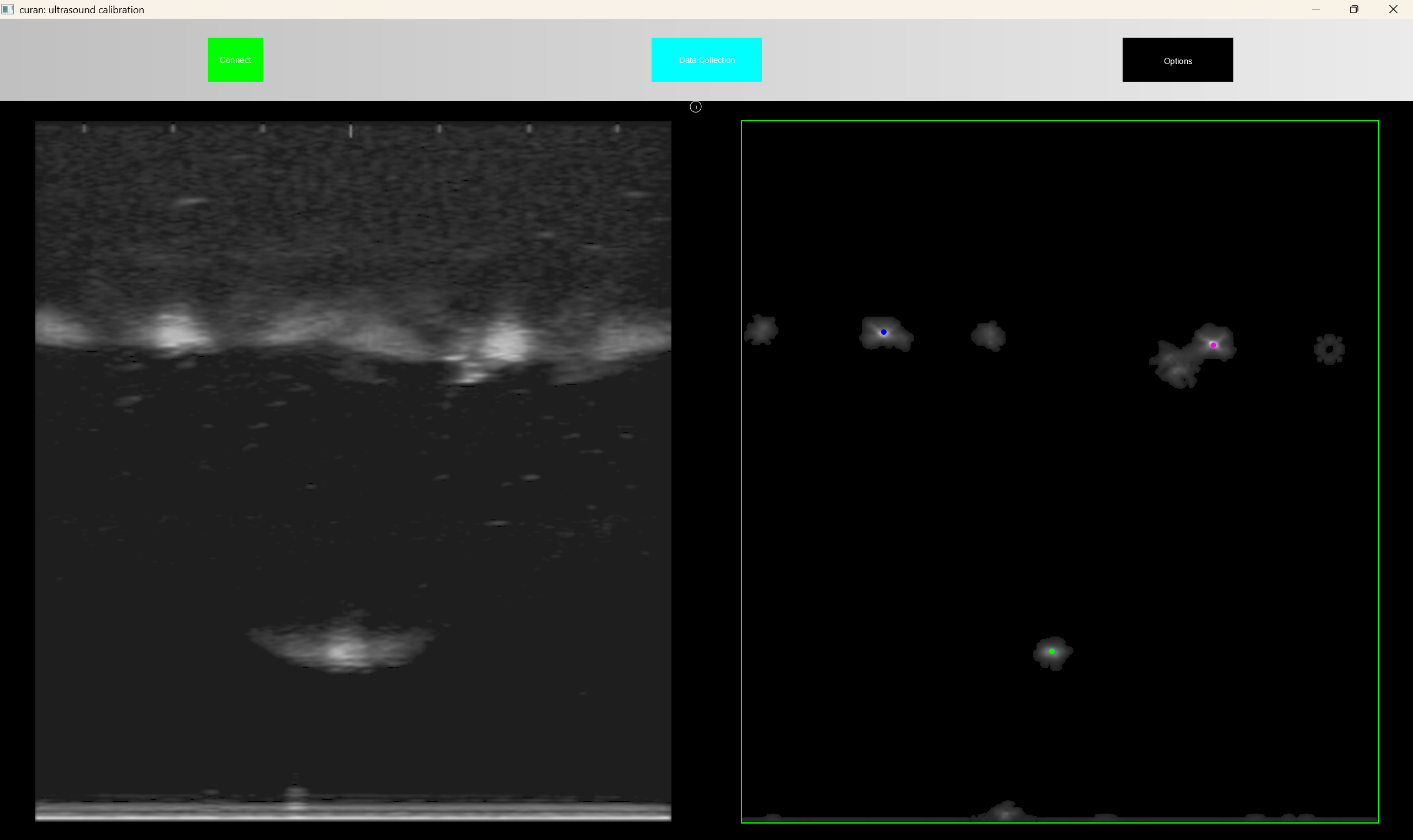 ultrasound_calibration_circles