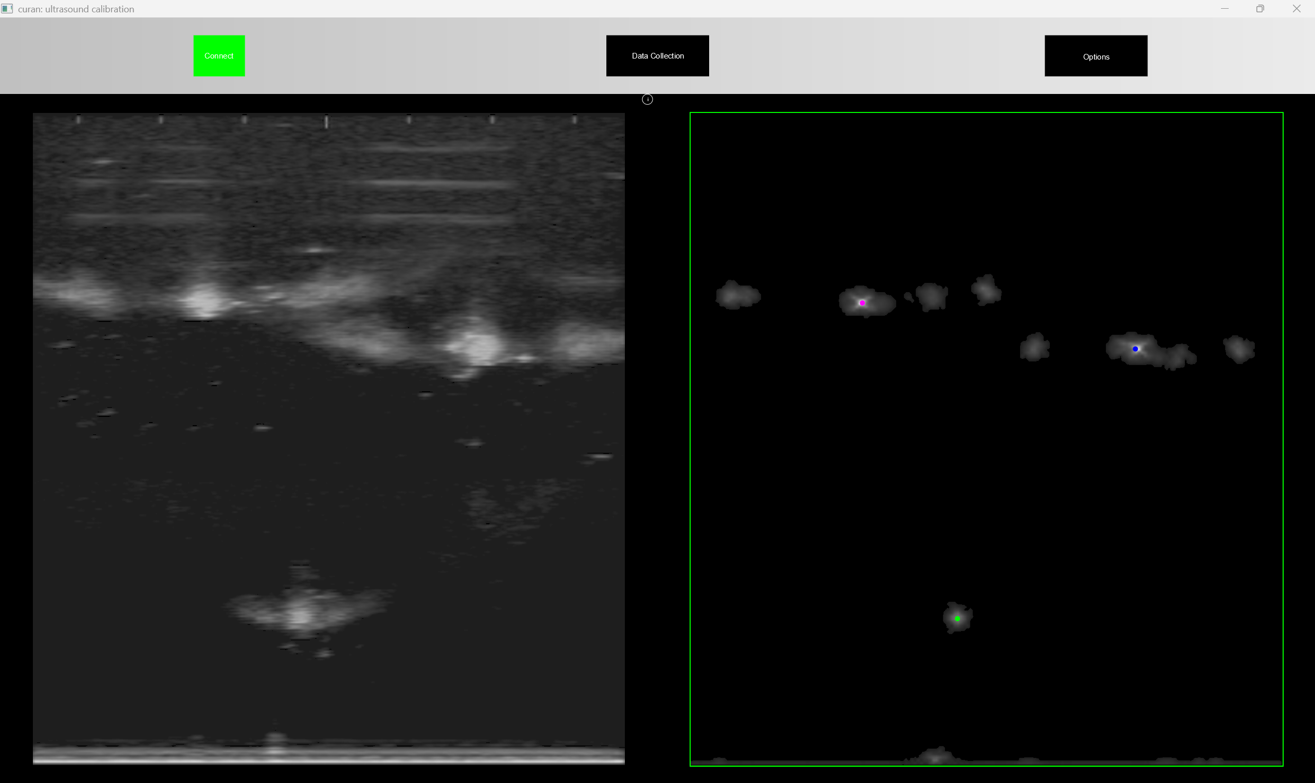 ultrasound_calibration_connected