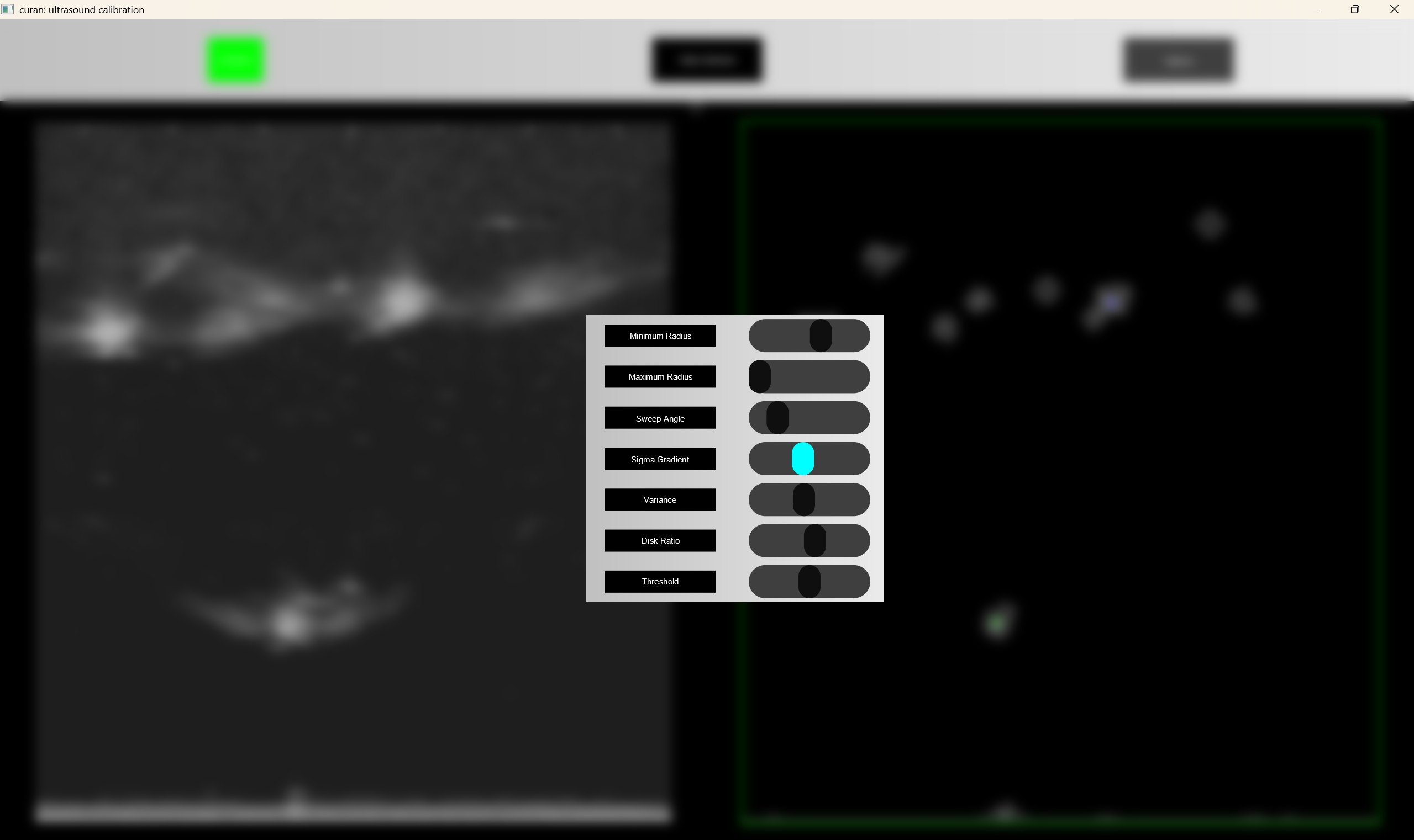 ultrasound_calibration_filter_options
